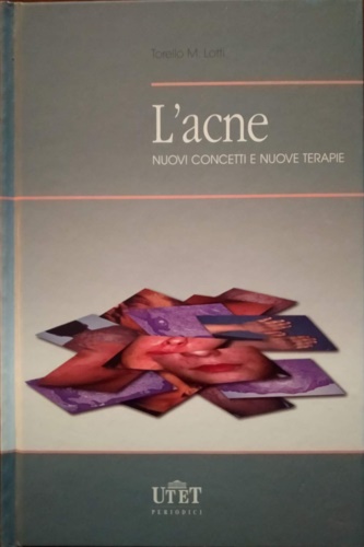 9788879332569-L'acne. Nuovi concetti e nuove terapie.